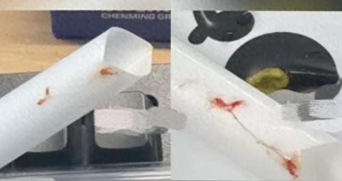 饮痰在线视频,揭秘痰液的秘密与健康管理之道